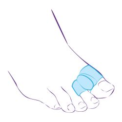 СТ-54.2 Межпальцевая перегородка с кольцами