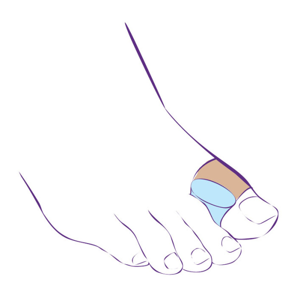 Перегородка межпальцевая на второй палец стопы увеличенного размера СТ-54.4  Trives